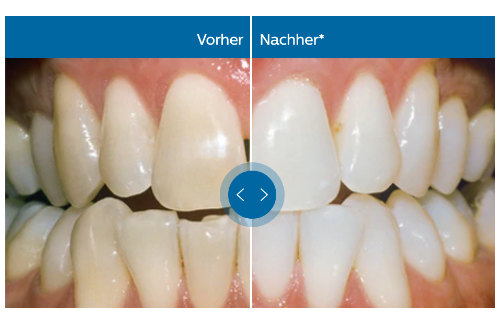 beitrag bleaching